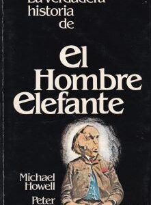 La verdadera historia del el hombre elefante