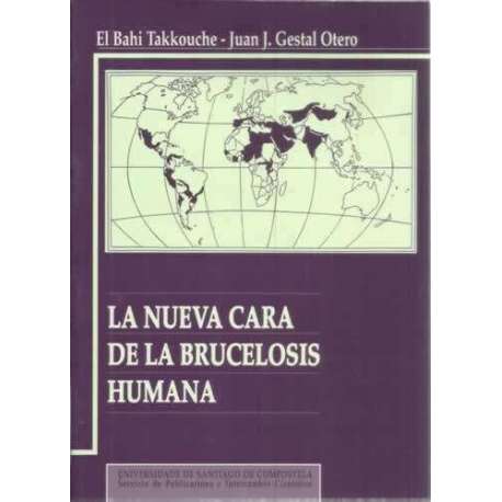 La nueva cara de la brucelosis humana