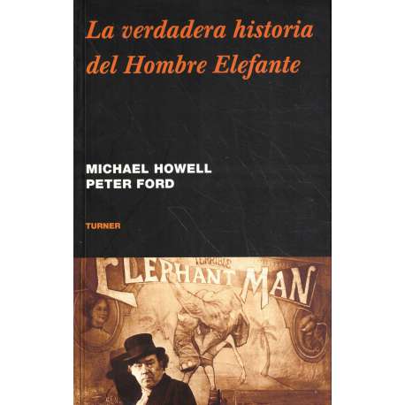 La verdadera historia del Hombre Elefante