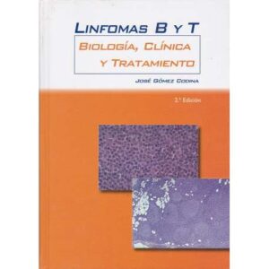 Linfomas B y T. Biología, clínica y tratamiento